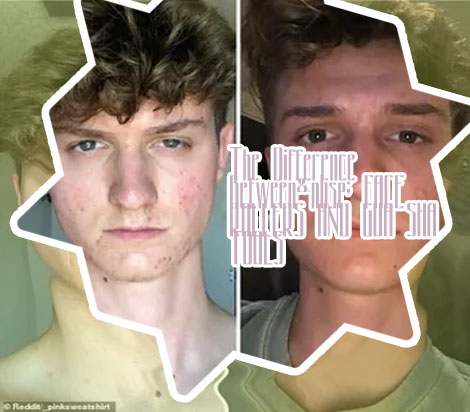 Face roller jawline